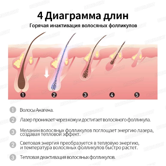 product-554-557 product-554-557